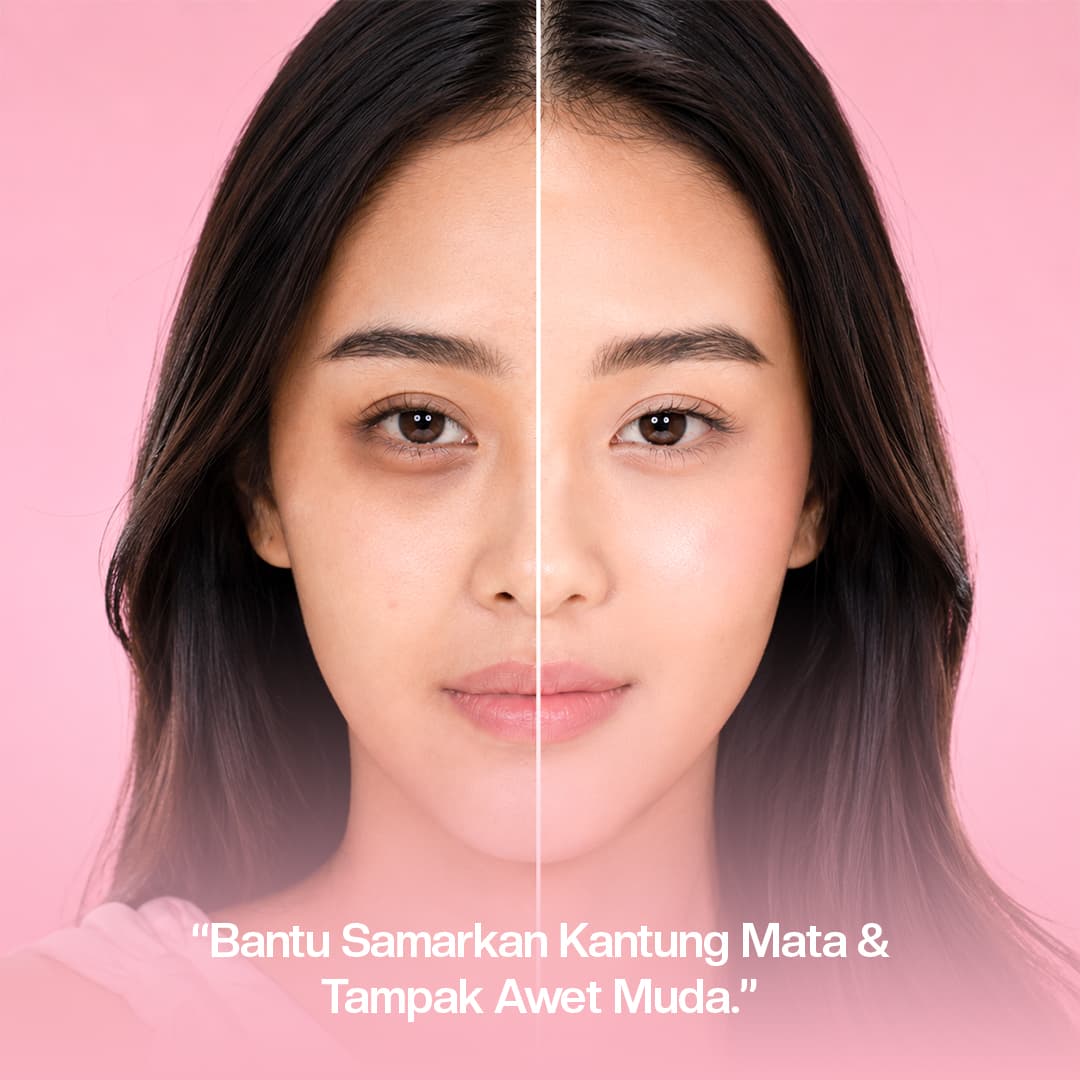 Kantung Mata Hitam Bikin Wajah Terlihat Lelah Terus?